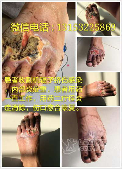 天正邱药堂－提子膏_0