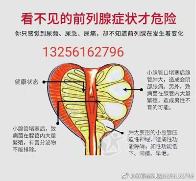 西安留意英草前列贴和其它贴的区别是什么_0