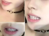 杭州矫正牙齿哪家好？