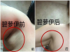 碧萝伊力之源精华