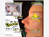 值得拥有的肋骨鼻综合，厂家供应