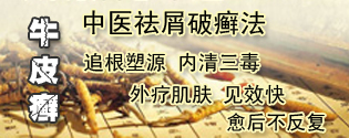 云浮治牛皮癣医院在哪9用偏方治疗牛皮癣有危害吗_0