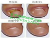 威海岳家修脚技术班长期培训零基础学员