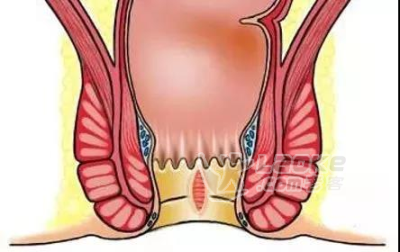 深圳天元中医肛肠医院怎么样——肛门失禁有哪些症状_1