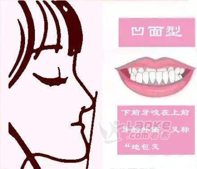乳牙反合是怎样形成的？_0