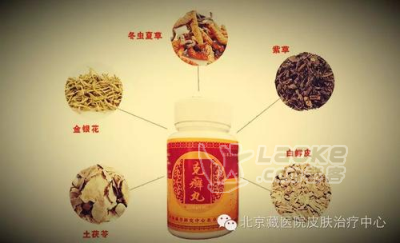 牛皮癣的克星——克癣丸_2