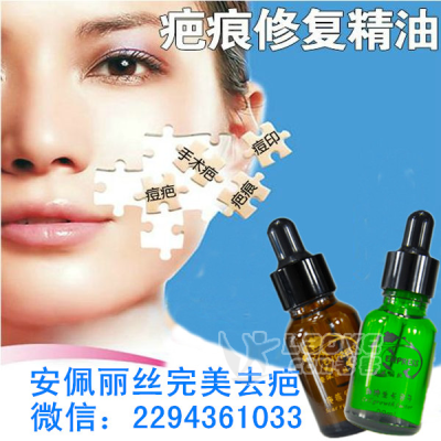 爱美不能留下痘坑痘疤该怎么祛疤效果比较好？_0