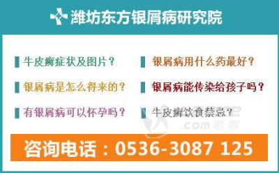 东营哪家医院银屑病看的好m.wfpfb.cn_0