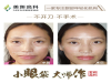 太爽了！眼袋竟然点一下就可以消除？